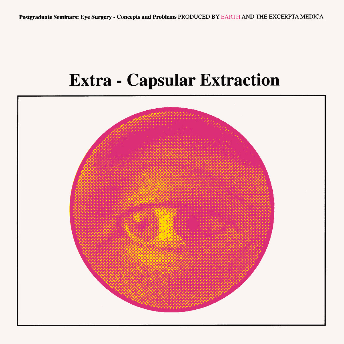 Extra-Capsular Extraction (RSD 2026) – Sister Ray